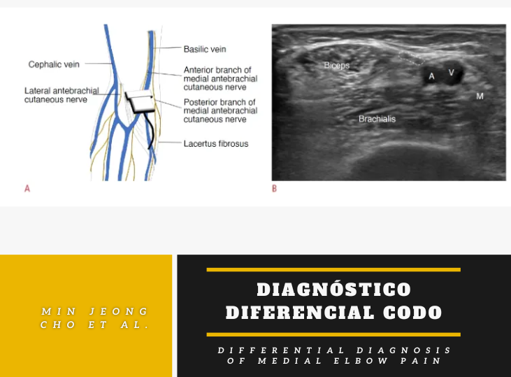 diagnostico-diferencial-del-codo-y-ecografia-parte-ii